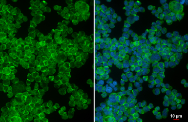 Anti-CX3CR1 antibody [HL3763] used in Immunocytochemistry/ Immunofluorescence (ICC/IF). GTX641962
